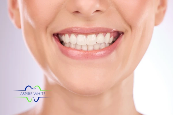 Follow your teeth whitening aftercare Coventry to prolong your whiter smile!