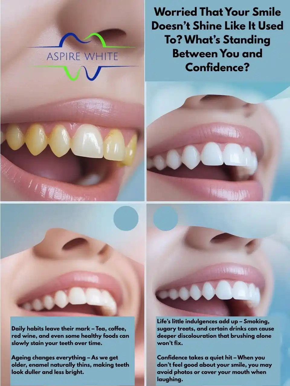 Worried That Your Smile Doesn’t Shine Like It Used To What’s Standing Between You and Confidence Coventry